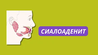 Что такое СИАЛОАДЕНИТ? Причины, лечение.