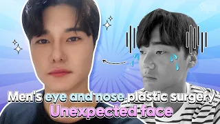 [Male Rhinoplasty VLOG] Extreme Plastic Surgery Before and After!👍🏻Double eyelid surgery