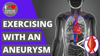 How safe is it to exercise with an Aneurysm?