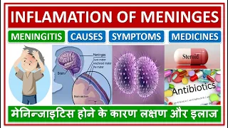 MENINGITIS, INFLAMATION OF MENINGES OF BRAIN, TREATMENT, मेनिन्जाइटिस होने के कारण लक्षण और इलाज
