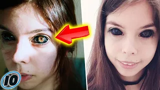 Model Left Blind After Tattooing Her Eyes Black