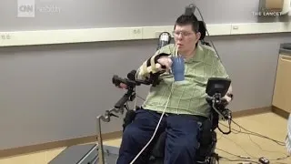 Paralyzed man moves hand