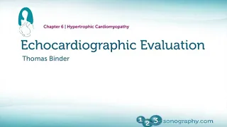 Echocardiography Hypertrophic Cardiomyopathy - Evaluation, Parameters to Assess