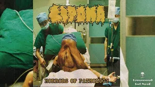 ➤ LIPOMA - Demonic Cult of Disease-☠(TRACK PREMIERE 2022)☠