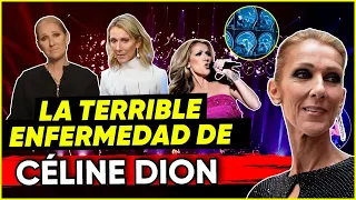 MÉDICO EXPLICA ENFERMEDAD DE CÉLINE DION 🧐 | MR DOCTOR | Síndrome de la Persona Rígida