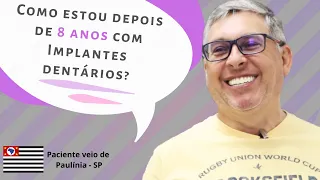 Implante Dentário (Protocolo All on 4) Depois de 8 Anos! [Depoimento Implace]