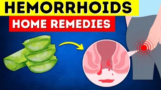 Say Goodbye to Hemorrhoids: 8 Home Remedies That Actually Work