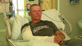 RAW INTERVIEW: Invasive plant sends teen to hospital, burn unit