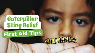 Caterpillar Sting Relief: How to Treat Caterpillar Stings - First Aid Tips | The Guardians Choice