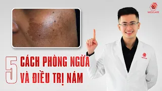 5 CÁCH ĐỂ PHÒNG NGỪA VÀ ĐIỀU TRỊ NÁM | MEDCARE