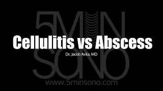 Differentiating Cellulitis from Abscess with POCUS