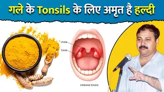 गले के टोंसिल (Tonsils) का नहीं करवाना होगा ऑपरेशन, कुछ ही दिनों में ठीक करेगी हल्दी - Rajiv Dixit