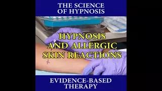 Toronto Hypnotherapist's Hypnosis Clip # 031 - Hypnosis and Allergic Skin Reactions