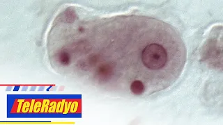 Amoebiasis kills 2, downs hundreds in San Carlos, Negros Occidental | TeleRadyo