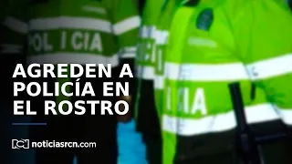 Patrullera de la Policía resultó gravemente herida en su rostro luego de atender un llamado por riña