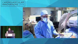 CVI2018 Session: Live Structural Case from Scripps Clinic (Aspen Ballroom, July 27)