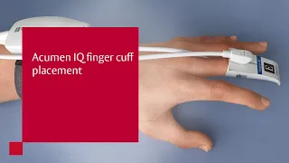 Acumen IQ finger cuff placement