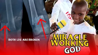 MIRACLE WORKING GOD | A GIRL WITH BROKEN LEGS HAS BEEN HEALED.