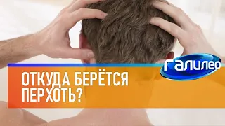 Галилео 🦱 Откуда берётся перхоть?