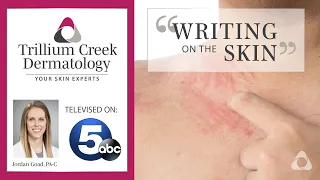 Dermatographism - Writing on the Skin