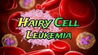 Hairy Cell Leukemia - CRASH! Medical Review Series