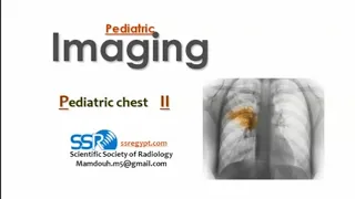 Pediatric chest imaging (II) (DRE) Prof. Mamdouh Mahfouz