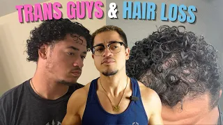 WHY TRANS GUYS GO BALD | FTM transition and hair loss