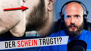 WAS wäre wenn er JETZT nach 3 Monaten Minoxidil absetzt ? | Bartwuchs Info Check