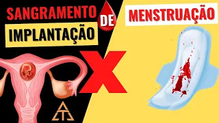 SANGRAMENTO DA IMPLANTAÇÃO DO EMBRIÃO (NIDAÇÃO) x MENSTRUAÇÃO: saiba como diferenciar!