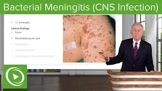 Bacterial Meningitis (CNS Infection) – Infectious Diseases | Lecturio