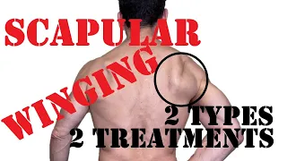 Scapular Winging - 2 Types, 2 Treatments