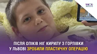 Після опіків ніг Кирилу з Горлівки у Львові зробили пластичну операцію