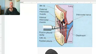 Anatomy of the thorax 2023 in Arabic(Applied anatomy of pleura & lung , part 1), by Dr. Wahdan