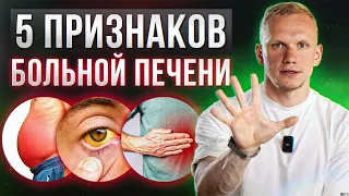 Как ОПРЕДЕЛИТЬ здоровье своей ПЕЧЕНИ? / Главные признаки того, что вашей печени нужна помощь!