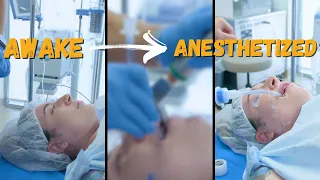 Going from Awake to Under General Anesthesia