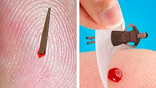 IF A SPLINTER WAS A PERSON! DIY Life Hacks & Funny Situations By Crafty Panda How