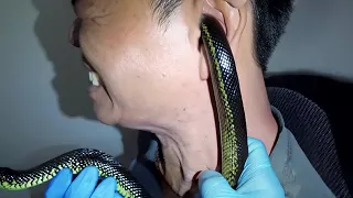 snake got stuck in his ear..
