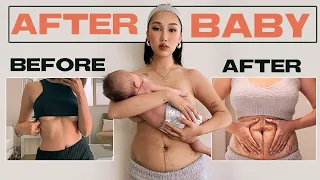 THIS IS MY POSTPARTUM BODY 😱 | Boob Job After Baby, Postpartum Depression...