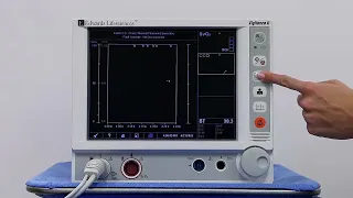 Vigilance II monitor: Intermittent Thermodilution Cardiac Output with CO-Set+ system