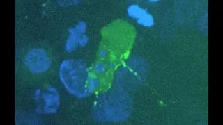 Caught on Camera: How HIV Infects Cells