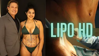 VLOG DA MINHA LIPO HD - Mostrei tudooo 🔥