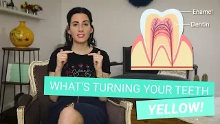 Why your teeth are turning yellow