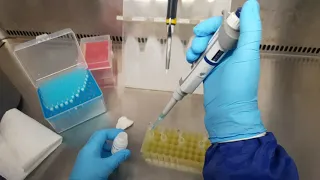 Virus DNA Extraction/ Virus RNA extraction/ Virus Nucleic Acid Extraction Step by step procedure