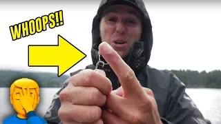 Best Way To Remove A FISHING HOOK. Real Life Demonstration!