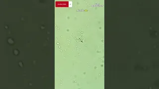 Blister Fluid Under Microscope (White Blood Cells) #shorts #trending #viral #microscope #zoom #1000x