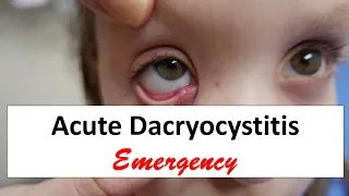 Acute Dacryocystitis Emergency