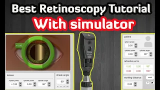 Retinoscopy Simulator | Practice Online | Tutorial