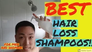 5 BEST HAIR LOSS SHAMPOOS FOR MEN AND WOMEN!!