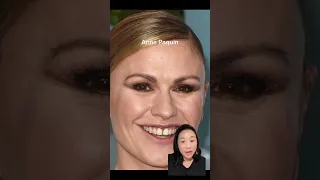 Does Anna Paquin have dental veneers? Veneercheck