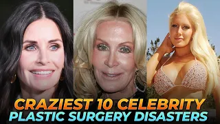 Top 10 Craziest Celebrity Plastic Surgery Disasters